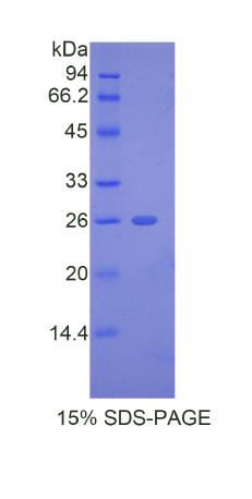 Recombinant A Disintegrin And Metalloproteinase With Thrombospondin 12 (ADAMTS12