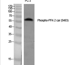 PFK-2 car (phospho Ser483) Polyclonal Antibody