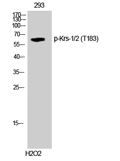p130 Cas (phospho Tyr249) Polyclonal Antibody