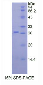 A Disintegrin And Metalloprotease 17 (ADAM17), Recombinant Protein