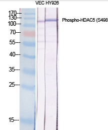 HDAC5 (phospho Ser498) Polyclonal Antibody