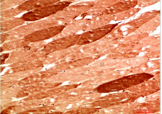 NBR1 Rabbit Polyclonal Antibody
