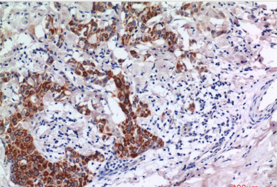 Smad3 Mouse Monoclonal Antibody(1E8)