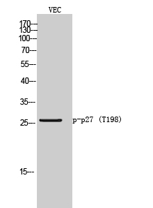 p27 (phospho Thr198) Polyclonal Antibody