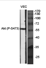 Akt (phospho Ser473) Polyclonal Antibody