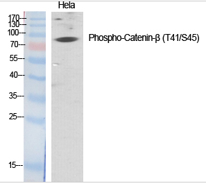 Catenin-β (phospho Thr41/S45) Polyclonal Antibody