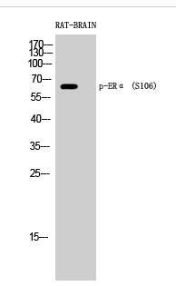 ERα (phospho Ser106) Polyclonal Antibody