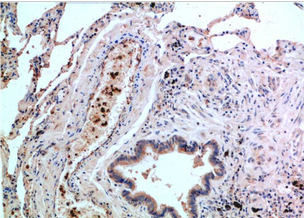 P38 Mouse Monoclonal Antibody(1G1)