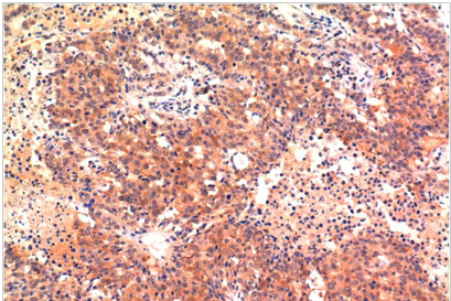 LC3A Mouse Monoclonal Antibody(5G10)