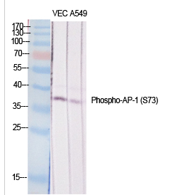 AP-1/Jun D (phospho Ser73/100) Polyclonal Antibody