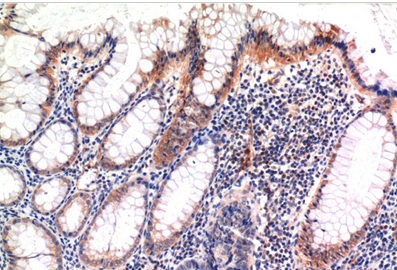phospho-MLKL (S358) Mouse Monoclonal Antibody(6F8)