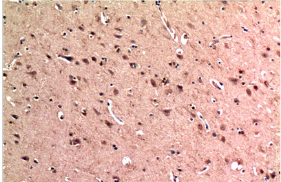 Beclin-1 Mouse Monoclonal Antibody(5C2)