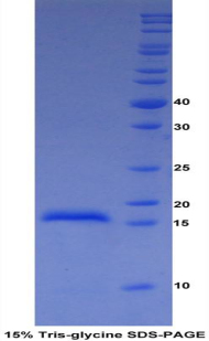 Recombinant A Disintegrin And Metalloproteinase With Thrombospondin 2 (ADAMTS2)