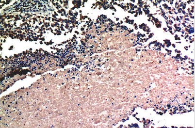 AKT Mouse Monoclonal Antibody(1E11)