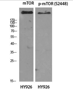 mTOR (phospho Ser2448) Polyclonal Antibody
