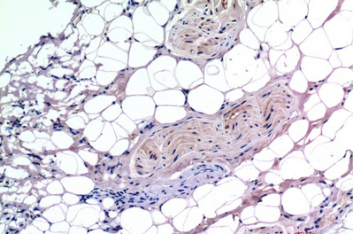 Smad3 Mouse Monoclonal Antibody(4C9)