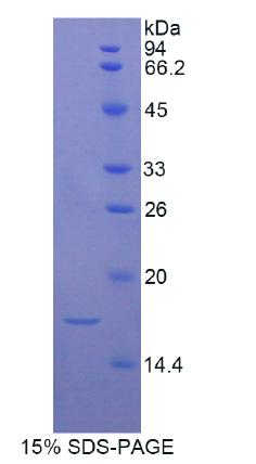 Recombinant A Disintegrin And Metalloproteinase With Thrombospondin 7 (ADAMTS7)