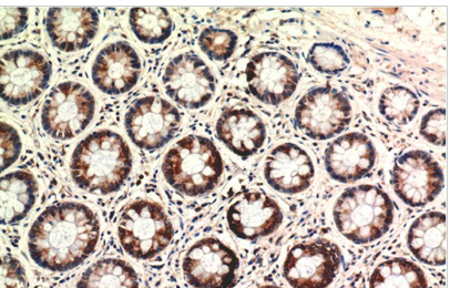 PTEN Mouse Monoclonal Antibody(2C10)