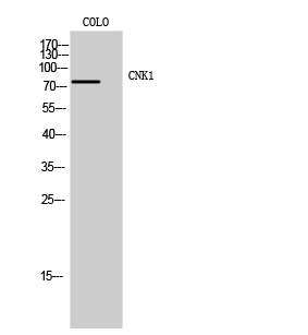 CNK1 Polyclonal Antibody