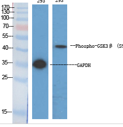 GSK3β (phospho Ser9) Polyclonal Antibody