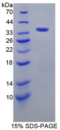 Recombinant A Kinase Anchor Protein 11 (AKAP11)