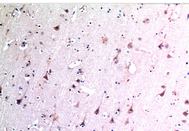 Beclin-1 Mouse Monoclonal Antibody(5A11)