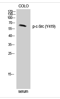 c-Src (phospho Tyr419) Polyclonal Antibody