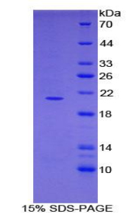 Recombinant A Disintegrin And Metalloproteinase With Thrombospondin 2 (ADAMTS2)