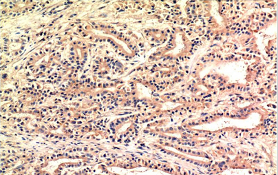 CHOP Mouse Monoclonal Antibody(1E1)