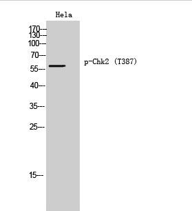 Chk2 (phospho Thr387) Polyclonal Antibody