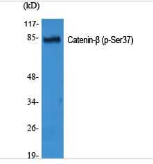 Catenin-β (phospho Ser37) Polyclonal Antibody