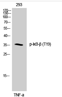 IκB-β (phospho Thr19) Polyclonal Antibody