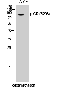 GR (phospho Ser203) Polyclonal Antibody