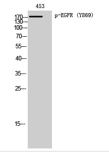 EGFR (phospho Tyr869) Polyclonal Antibody