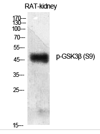 GSK3β (phospho Ser9) Polyclonal Antibody