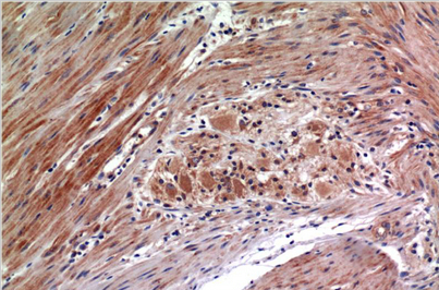 Phospho-ERK 1/2 (Y222/205)Mouse Monoclonal Antibody(4G3)