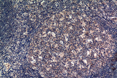 MLKL Mouse Monoclonal Antibody(8H7)