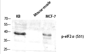 eIF2α (phospho Ser51) Polyclonal Antibody