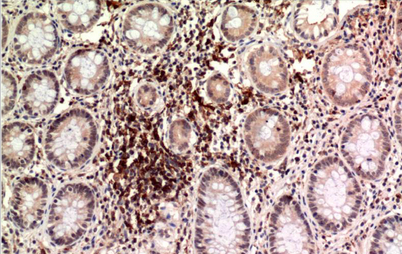 Epsilon Tubulin Mouse Monoclonal Antibody(3G1)