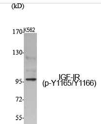 IGF-IR (phospho Tyr1165/Y1166) Polyclonal Antibody