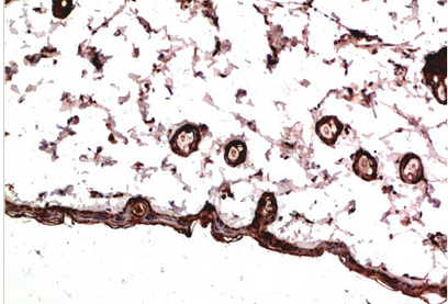 PDGFRα Mouse Monoclonal Antibody(7A3)