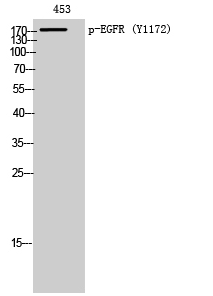 EGFR (phospho Tyr1172) Polyclonal Antibody
