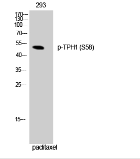 TPH1 (phospho Ser58) Polyclonal Antibody