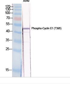 Cyclin E1 (phospho Thr395) Polyclonal Antibody