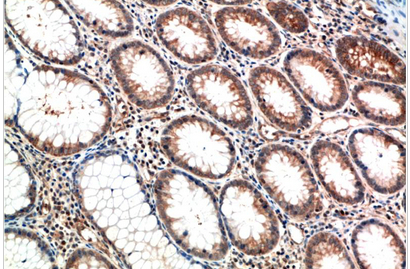 ATM Mouse Monoclonal Antibody(1D1)