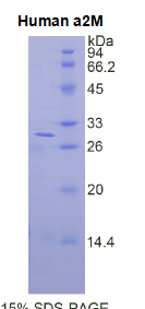 Alpha-2-Macroglobulin (a2M)