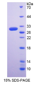 Recombinant Regucalcin (RGN)