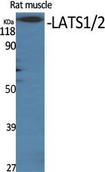 LATS1/2 Polyclonal Antibody