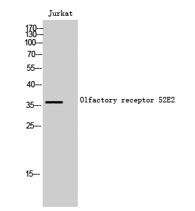Olfactory receptor 52E2 Polyclonal Antibody