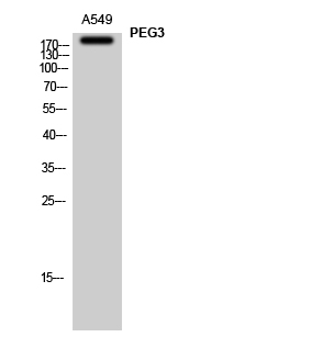PEG3 Polyclonal Antibody